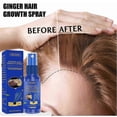 thumbnail image 2 of EELHOE Ginger Hair Growth Spray Scalp Massage Moisturizing Thick Hair Hair Care Nutrient Spray, 2 of 4