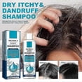 thumbnail image 5 of Seborrheic-Dermatitis Treatments Shampoo, Anti Dandruff Itch Control Hair Care Shampoo, for Men Women, 5 of 5