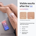 thumbnail image 5 of Braun IPL Skin i·expert, At home Hair Removal, with free app, 4 heads, PL7387, 5 of 13