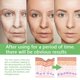 thumbnail image 5 of Suero facial eliminador de arrugas Esencia antienvejecimiento Hidratante Iluminador Nutritivo Atenúa líneas finas Reparador Reafirmante facial Cuidado de la piel, 5 of 6