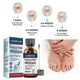 thumbnail image 5 of Extra Strength Anti-Fungal Nail Liquid - Repair Grey, Discolored & Thick Nails, Quick Absorption Nail Strengthening Liquid for All Nail Types, 5 of 5