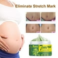 thumbnail image 4 of OUSITAID Pregnancy Repair Cream Stretch Removal Easy to Absorb Natural Extracts Skin Scar Remove Cream for Mother, 4 of 10