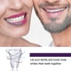 thumbnail image 5 of Tooth Stain Removal, 5 of 5
