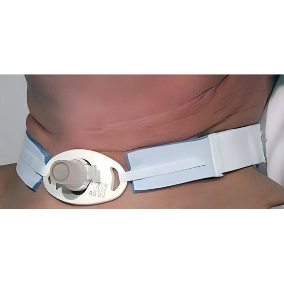 AirLife Tracheostomy Tube Holder, Hook And Loop Tab, 1 Inch Wide X 14 Inches Long, 10 Count