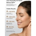 thumbnail image 6 of Red Light  for  and  Beauty Device for Puffiness &  Firming Skincare Tool (White), 6 of 7