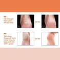 thumbnail image 4 of 1pcs Electric Foot Rasp, Rechargeable Electric Pedicure Foot Rasp, Replacement Frosted Head Electric Rasp, Remove Dead Skin, 4 of 5