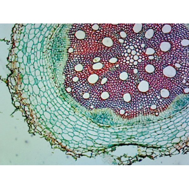 Sunflower (Helianthus) Stem; Typical Monocot Stem; Cross Section