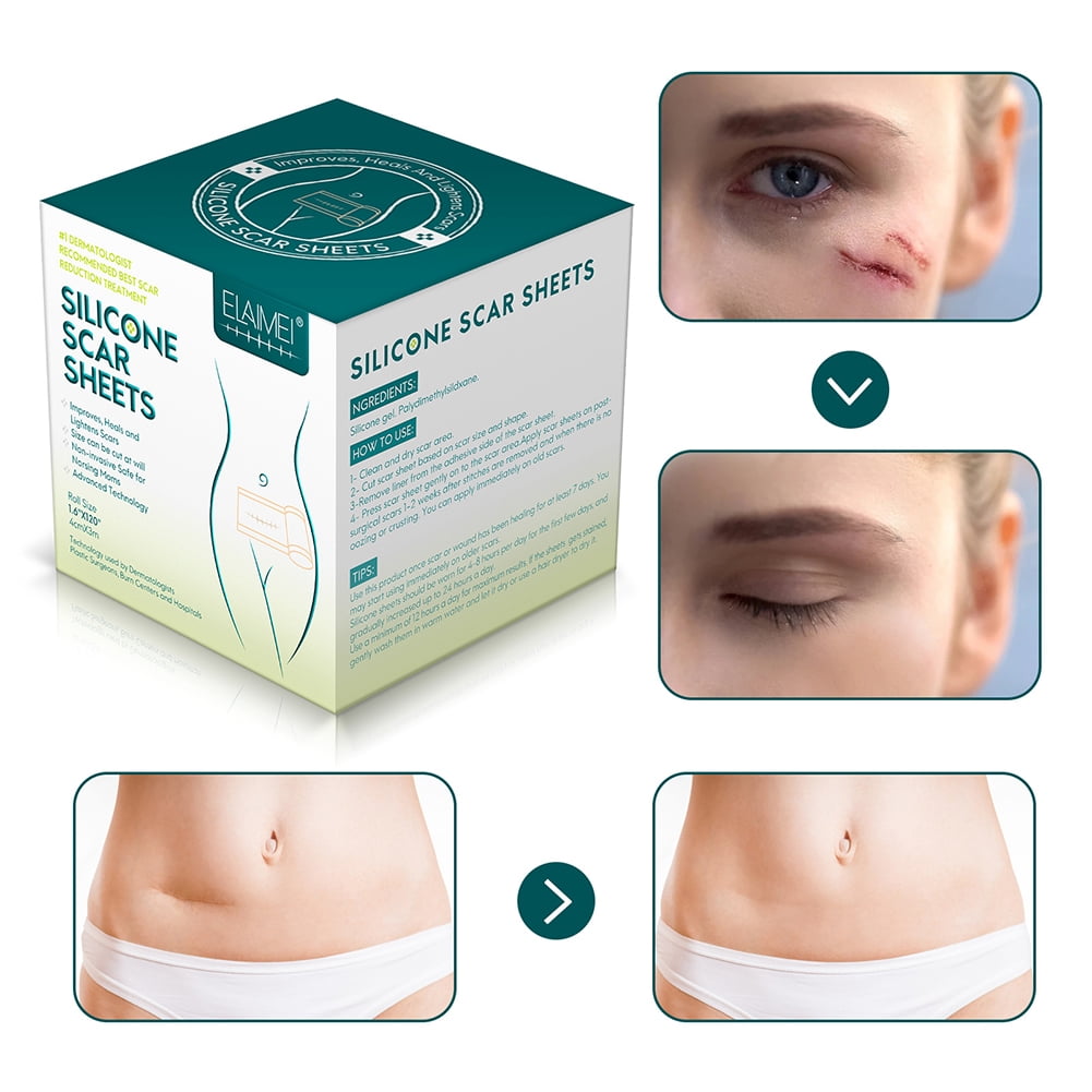 Silicone wrap for scars outlet