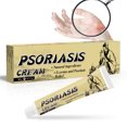 thumbnail image 3 of Crema para el Tratamiento de la Psoriasis de 20g Crema Corporal Calmante para el Sarpullido Blanco Rojo Rosa Varios Problemas de la Piel Ingredientes Naturales sin Hormonas ANGGREK Otros, 3 of 8