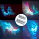 thumbnail image 3 of Mayúsculas Del Teclado Juguete antiestrés con teclado mecánico, 1 pieza, con interruptores transparentes retroiluminados y teclas de cristal, altura xDA, para mochila. JASKFLY, 3 of 9