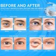 thumbnail image 2 of Parches para ojeras: 30 pares de geles de colágeno y retinol para ojos, reducen las arrugas, las bolsas y las bolsas, almohadillas para el tratamiento de la piel, humectante antienvejecimiento para mu, 2 of 5