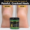 thumbnail image 6 of FOOT SPA - Exfoliating Scrub Gel, 16 Oz - Manicure, Pedicure and Body Exfoliator Infused with Aloe Vera and Salicylic Acid - Glow, Polish, Smooth and Moisture Skin - Body, Hand and Foot, 6 of 7