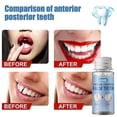 thumbnail image 4 of 1-3pcs Temporary Tooth Repair Moldable Fix Broke Gap Teeth False Teeth Solid Glue 30ml, 4 of 5