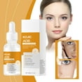 Advanced Night Drying Lotion Korean Face Lotion Korean for Oily Skin Lip Korean Lip Care
