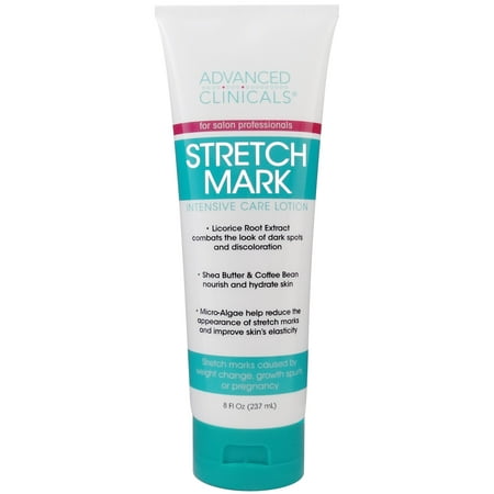 Advanced Clinicals Stretch Mark Lotion. Moisturizing Cream for Scars, Extreme Weight Loss, Pregnancy. 8oz Tube.