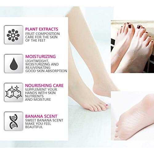 AICHUN BEAUTY Cracked Heel Cream Foot Care Banana Milk Cream Repair Relieves Rough Dry Skin Baby Foot Chilblains Hyperkeratosis 80g - Walmart.com