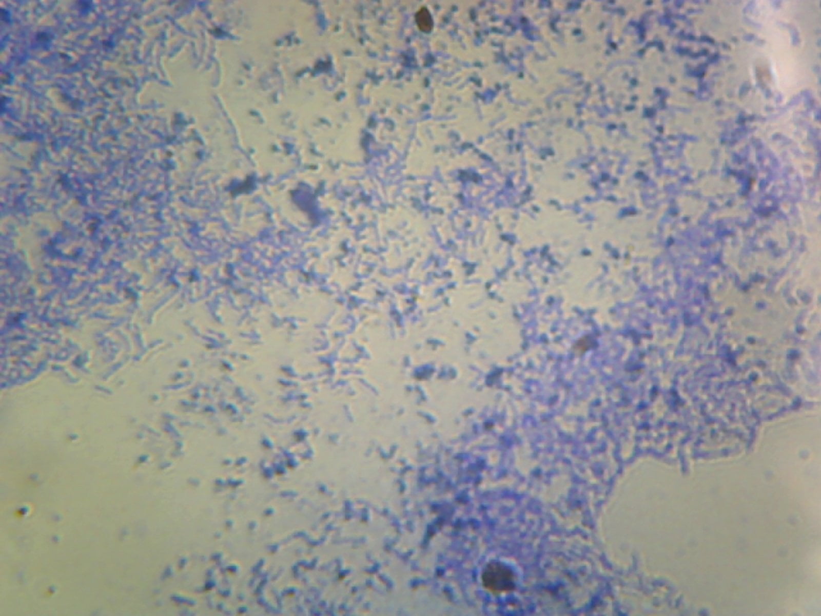 Лактобациллы фото под микроскопом