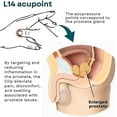 thumbnail image 4 of Alus Care Point Clip, L14 Sure Point Clips, Mine Pressure Point Clip, Alus Sure Hand Pressure Point Clip, S Bl, 4 of 5