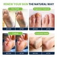 thumbnail image 4 of Foot Cure Tea Tree Foot Soak & Callus Remover Gel Kit - Remove Calluses with Epsom Salts, Callus Remover Gel for Calluses with Foot Exfoliator, Dry Cracked Heels & Foot Odor, 4 of 10