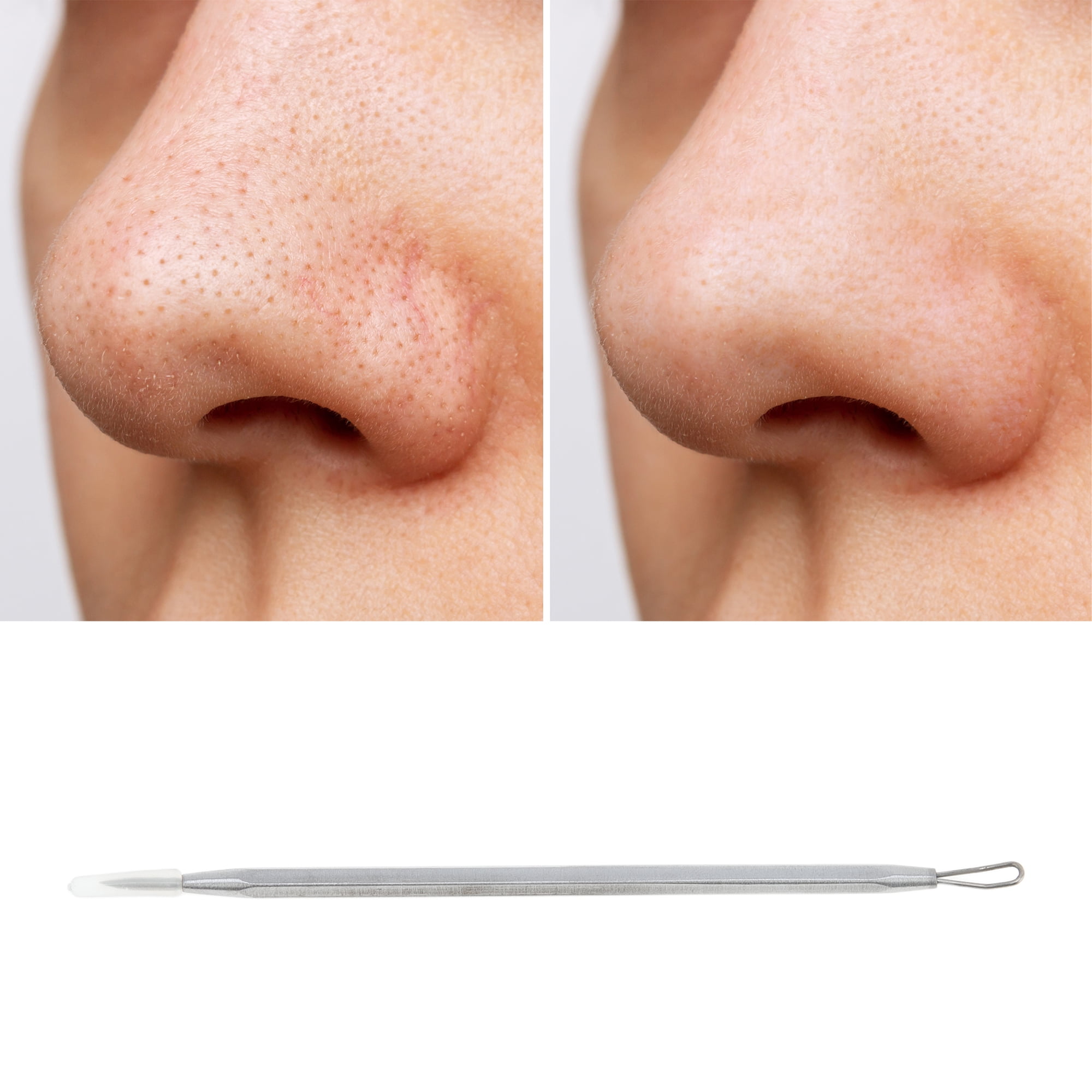 Unique Bargains 1pc Durable Squeeze Pimple Extractor Tool Silver Tone