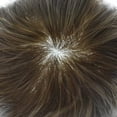 thumbnail image 4 of LYRICAL HAIR Lace Front Toupee for Men Indian Human Hair Replacement System  French Lace Mens Toupee Thin Skin Hairpieces for Man Bleached Front Knots Mens Hair Piece Unit, 4 of 6