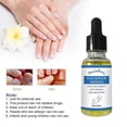 thumbnail image 2 of Nail Fungus Treatment Toenail Repair Essence Renew Damaged Discolored Foot and Toenails for Finger Toenail New, 2 of 4