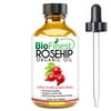 BioFinest Rosehip Oil - 100% Pure Cold-Pressed - Certified Organic - Chile Premium Rosehip Seed Oil - BEST Moisturizer for Face, Nails, Dry Hair & Skin - FREE Glass Dropper - 100ml (3.4 fl.Oz)