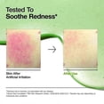 thumbnail image 3 of Anua Acid 10 Hyaluron Redness Soothing Serum Facial Spot Care 30ml 1oz, 3 of 5