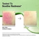 thumbnail image 3 of Anua Acid 10 Hyaluron Redness Soothing Serum Facial Spot Care 30ml 1oz, 3 of 5