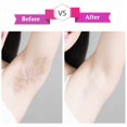 thumbnail image 3 of relayinert 400x Gentle And Effective Hair Removal For All Skin Types Suitable For All Skin Types Easy, 3 of 6