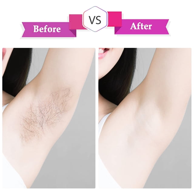 fastboy 400pcs/set Smoothness With Ease Non-Woven Wax Strips For Easy Hair Removal