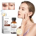 thumbnail image 4 of Fiudx Ofertas de la semana Suero exfoliate cítrico peeling químico para rostro Solución exfoliant peeling químico para rostro peeling facial exfoliant para pieles oscuras 30 ml, 4 of 7