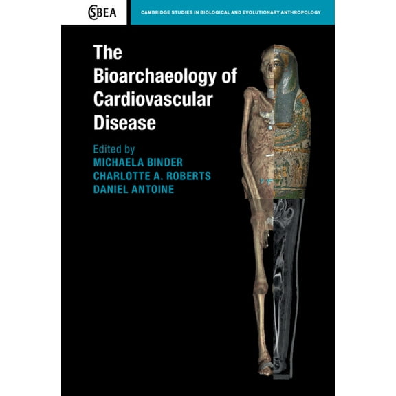 Cambridge Studies in Biological and Evol The Bioarchaeology of Cardiovascular Disease, Book 91, (Hardcover)
