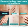 thumbnail image 3 of Dimora Silicone Scar Sheets, Extra Long Silicone Scar Tape, Waterproof Scar Treatment, Scar Removal Strips for Surgical Scars, C-Section, Keloid, Tummy Tuck, 1.6”x120" Roll, 3 of 7