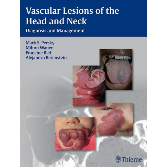 Vascular Lesions of the Head and Neck: Diagnosis and Management (Hardcover)