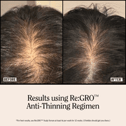 California Naturals Re:GRO Anti-Thinning Scalp Serum, 3 fl oz