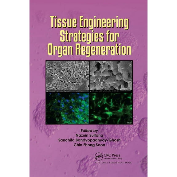 Tissue Engineering Strategies for Organ Regeneration, (Paperback)