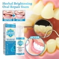 thumbnail image 2 of 3PCS Jorondy Teeth Mouthwash,30ml Herbal Brightening Oral Repair Foam Deeply Cleaning, 2 of 5