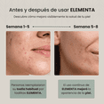 thumbnail image 2 of Elementa Toallas Faciales Secas Desechables Extra Grandes (Rostro Limpio y Sin Bacterias), Hipoalergénicas, 100% Biodegradables | Toallitas Desmaquillantes, Skin Care | 3 Paquetes con 50 Toallitas c/u, 2 of 8