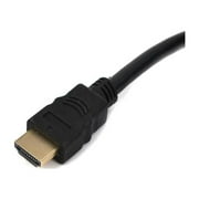 1080P HDMI-compatible Male Video to 3 RCA AV Audio Cable Cord For TV Adapter X2Y9