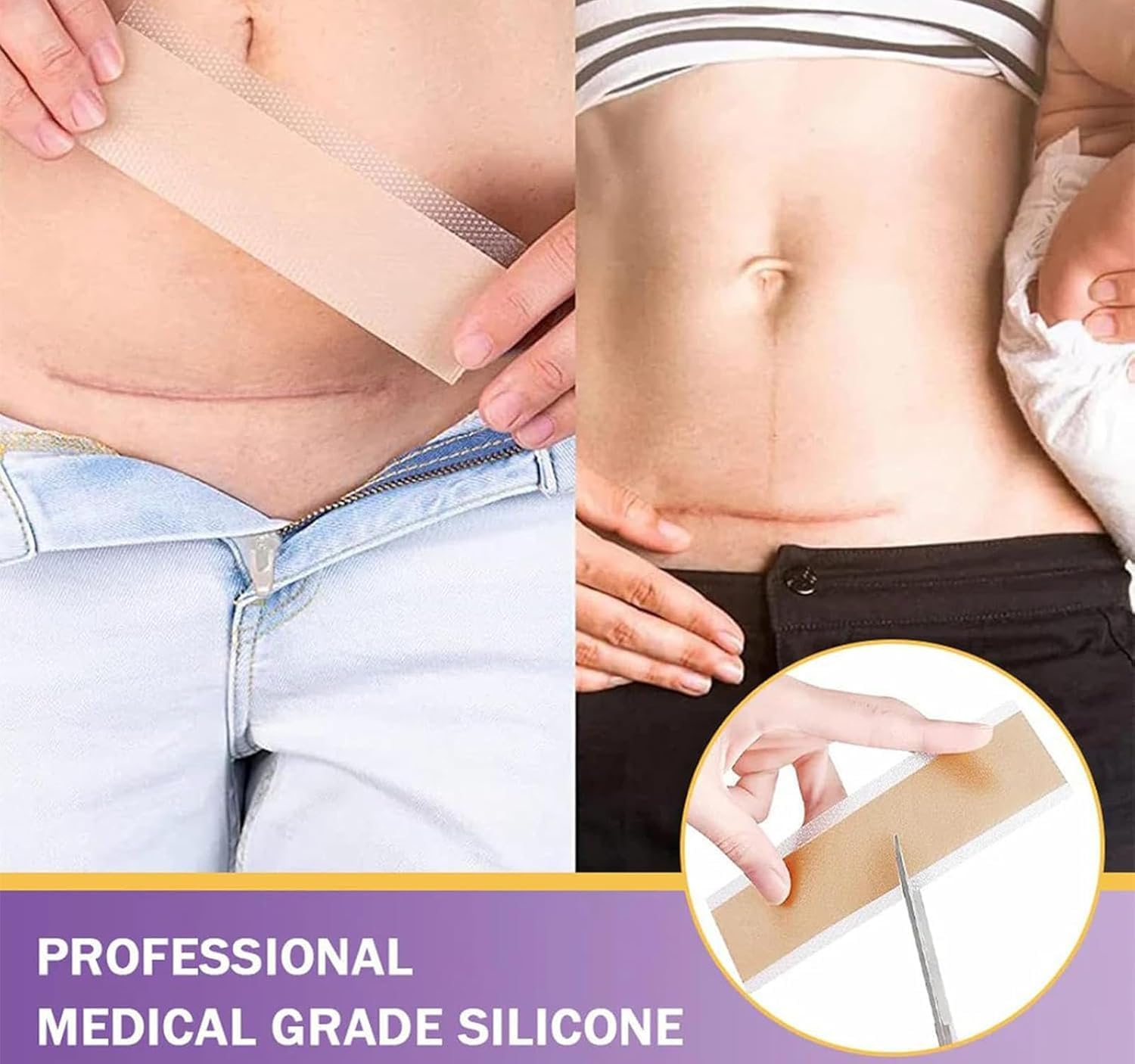 Risedora Hyaluronic Acid Nano Repair Tape, Silicone Scar Sheets and Face Tape for Wrinkles, Gentle Hydrating Scar Removal Tape for All Skin Types