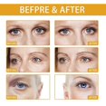thumbnail image 3 of Crema para ojos a base de puré de arroz que reduce las bolsas y las ojeras, crema hidratante antiarrugas para ojos - 20 g | 8078290656957, 3 of 3