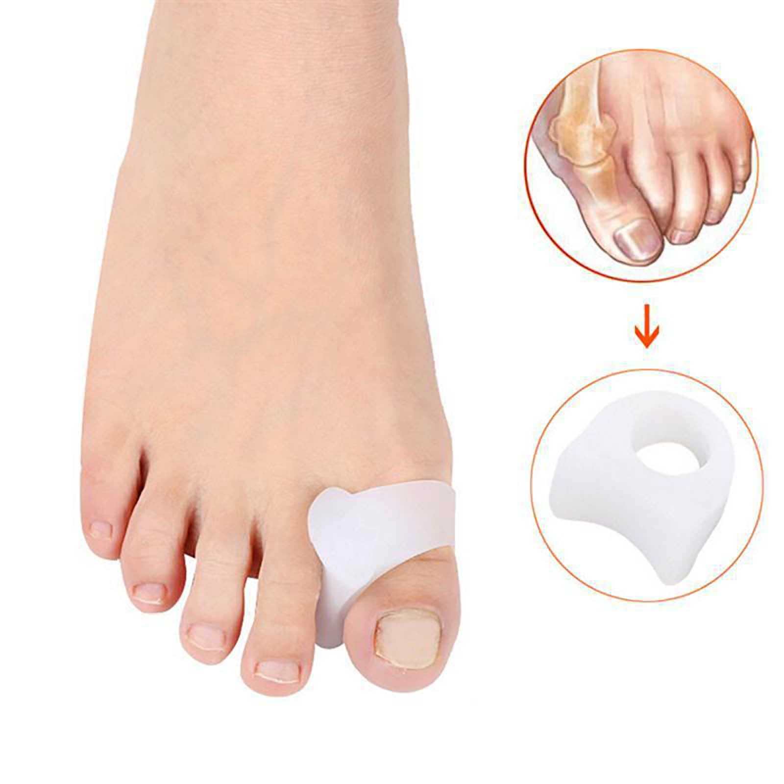 Peaoy 6Pcs Toe Separators with 2 Loops Silicone Bunion Corrector Big Toe  Spacer for Crooked and Overlap Toe (Beige)