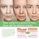 thumbnail image 4 of Suero facial con esencia de ácido hialurónico, hidratante, cuidado de la piel, crema blanqueadora de belleza coreana, crema reparadora y nutritiva con caracol, 4 of 6