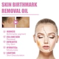 thumbnail image 5 of Barsme Birthmark Removal Oil,Help Lighten Birthmarks And Pigmentation.10Ml 3Pc, 5 of 9