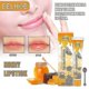 thumbnail image 2 of Lip Balm Moisturizing, Moisturizing, And Diluting Lip Lines I, 2 of 5