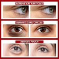 thumbnail image 5 of Anti-Puffiness Eye Serum for Dark Circles & Fat Granules 30ml, 5 of 5