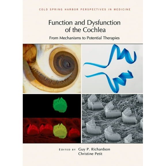 Perspectives Cshl Function and Dysfunction of the Cochlea: From Mechanisms to Potential Therapies, (Hardcover)