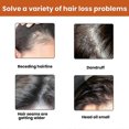 thumbnail image 2 of Champú anticaída Eelhoe para el crecimiento del cabello, línea de cabello gruesa, champú sólido nutritivo para la raíz del cabello, 3 piezas, 2 of 4