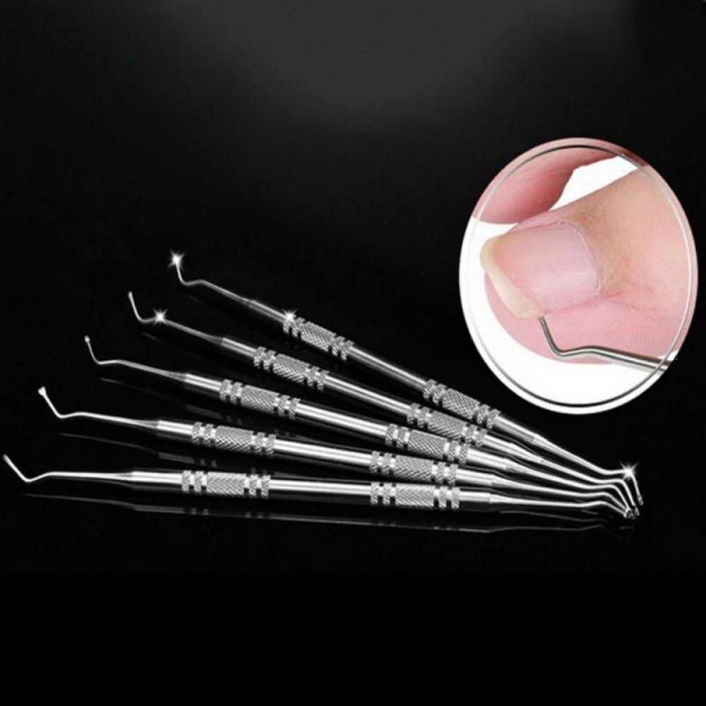 Toe Nail Orthotics Ingrown Toenail Correction Tool Pedicure Tool Feet